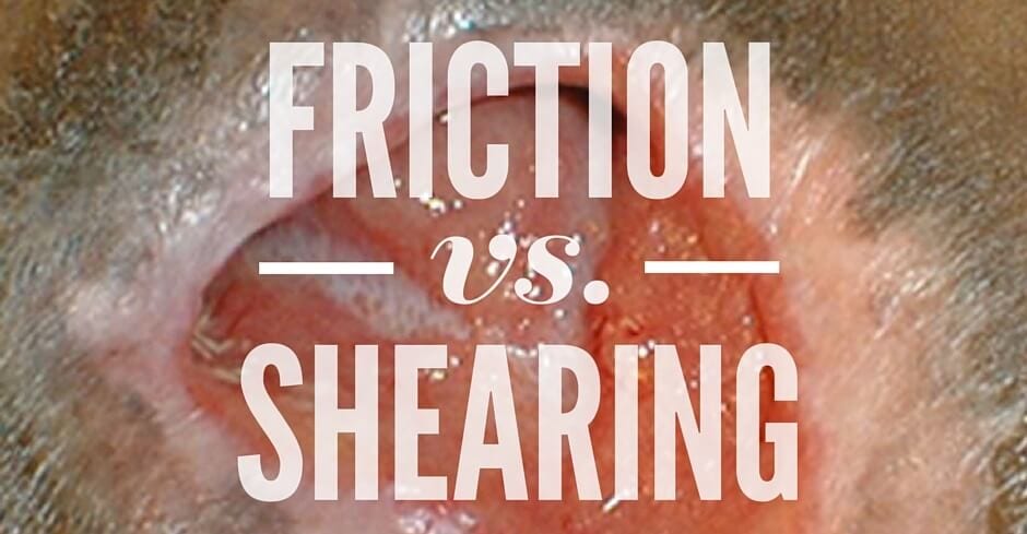 Friction vs. Shearing in Wound Care: What’s the Difference?