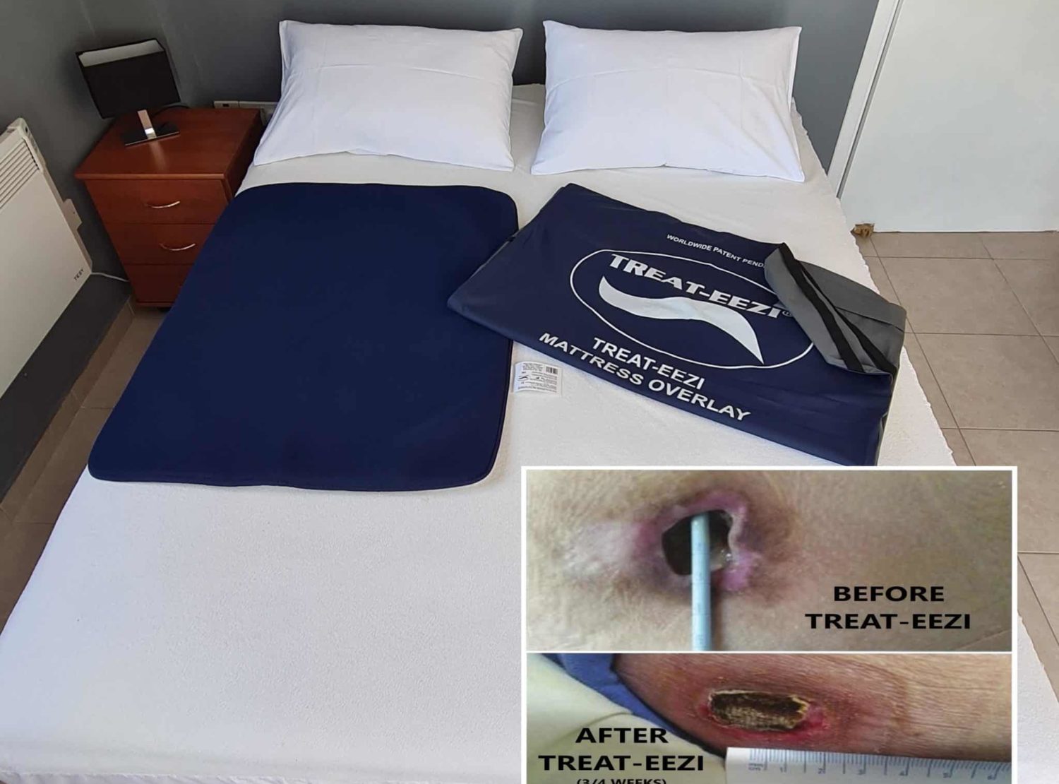 Pressure relief bed pads for bed sores UK & worldwide